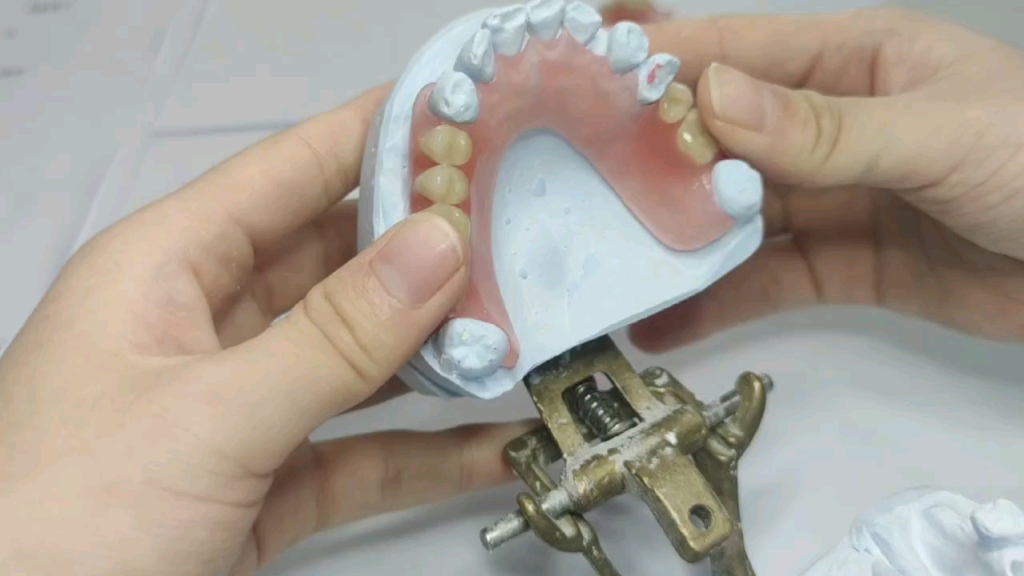flexible partial denture fabrication in dental lab